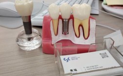 种牙牙冠材料怎么选？哪种更耐用又美观划算？