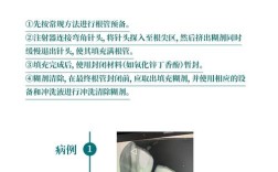 临床常用根管消毒方法各有何优缺点？如何合理选择用于不同病例？