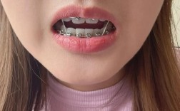 北京矫正牙齿哪家好？专业机构怎么选？