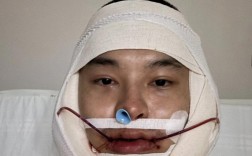 正畸正颌联合治疗术后，患者最关心的恢复时间、效果维持及日常护理要点有哪些？