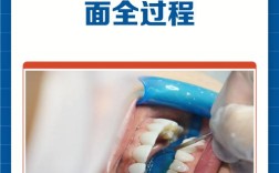 贴面方法和步骤的关键步骤有哪些？