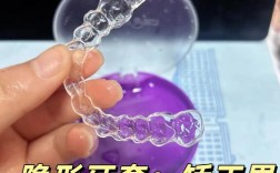 西安隐形矫正牙齿效果如何？价格多少？哪家靠谱？