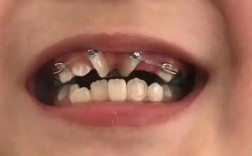 小孩牙齿多大可以矫正