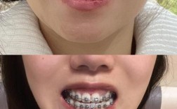 正畸正面微笑像是看什么