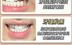 牙齿黄用什么方法美白