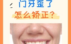 门牙突出矫正有哪些方法适合不同情况？