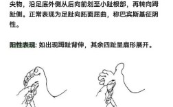 Tweed测量方法在正畸诊断中的核心指标有哪些？不同面部类型下如何优化其测量准确性？