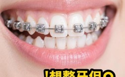 正畸牙套怎么选？隐形/金属/陶瓷哪种更适合？