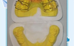 牙齿正畸材料有哪些