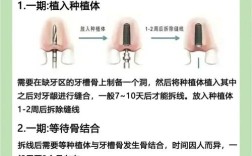 常州种植牙注意事项有哪些？这些关键点你必须知道吗？