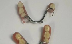 镶牙有哪些常用方法？哪种更适合自己？