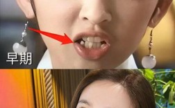 明星正畸前后对比照，颜值逆袭的真相是什么？