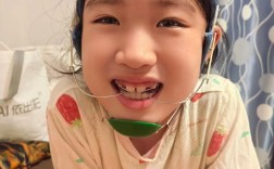 牙齿矫正头套怎么戴才对？新手必看的正确步骤