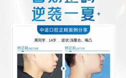 正畸照片编辑模板能解决哪些拍摄痛点？