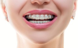 只矫正一颗牙齿可行吗？效果和风险如何？