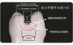 口腔嵌体制备方法的关键步骤与技巧有哪些？