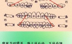口腔正畸八字结扎方法如何操作？有哪些注意事项？