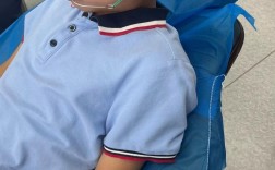 戴正畸头帽期间，还能正常吃东西吗？