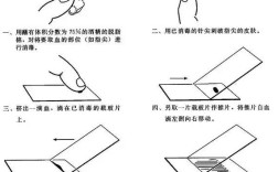 红膏二次印模方法的具体操作步骤是怎样的？如何确保其在口腔修复中的精准适配与稳定性？