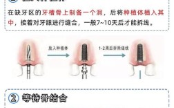 种植牙怎么接诊