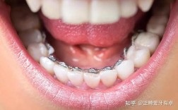 标准舌侧正畸弓形图下载渠道有哪些？