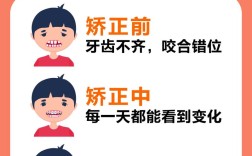 矫正龅牙要花多少钱？