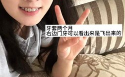 28岁还能矫正牙齿