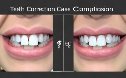 2025牙齿矫正案例对比，哪种效果更惊艳？