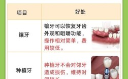 镶牙方法哪个好