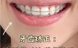 牙齿正畸为何说没有年龄限制呢？