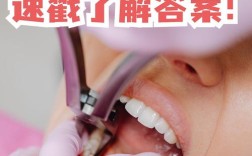 牙齿矫正智齿要拔吗