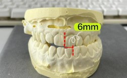 正畸都要做牙模吗