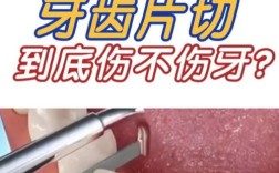 侧切牙有蛀牙/龋坏还能做正畸吗？烂牙未治好会影响矫正效果或导致牙齿健康问题吗？