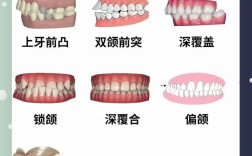 正畸大牙不齐要调整多久