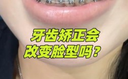 矫正牙齿到底能不能改变脸型？