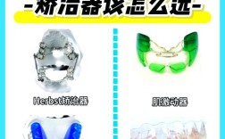 II类颌畸形矫正方法有哪些？不同矫正方式适用人群和效果差异如何？