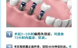 种牙后需保养吗？日常护理该注意什么？