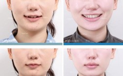 广州矫正牙齿去哪里好？专业机构怎么选才靠谱？