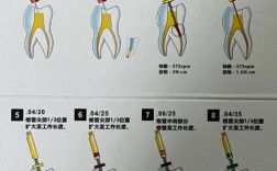 除了根管治疗，牙齿坏损还有哪些替代疗法？不同疗法在保留牙齿功能和长期效果上各有什么优劣？