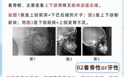 准备做牙齿正畸，需要拍哪些片子？这些影像检查分别有什么作用？