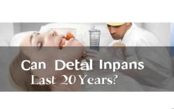 2025种植牙能用20年吗？最新临床数据回应