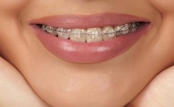 矫正牙齿垫牙一般需要多久？