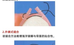 口腔手术缝合方法如何正确选择与操作？
