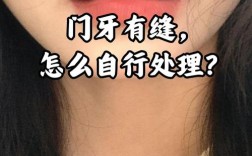 正畸后门牙为何会出现缝隙？