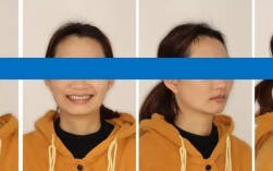 口腔正畸面相照拍摄角度如何确定？
