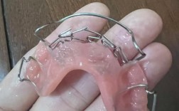 牙齿矫正与烤瓷牙能同时做吗？效果会如何？