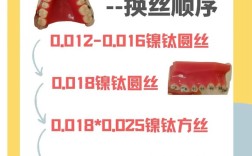 正畸扎丝选几号？型号选择有讲究吗？