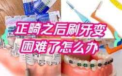 矫治器托槽的去除方法