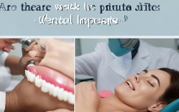 私人诊所种植牙风险几何？安全吗？