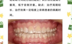 做牙齿矫正的缺点